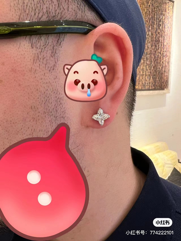 ルイヴィトンアクセサリー素材ディテール